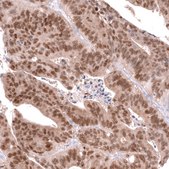 Anti-CDX2 antibody produced in mouse Prestige Antibodies&#174; Powered by Atlas Antibodies, clone CL12967, purified by using Protein A, buffered aqueous glycerol solution