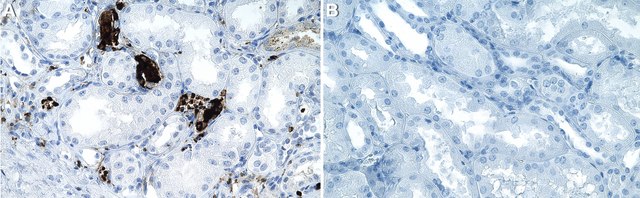 Anti-MCP-1 Antibody, clone 2G17 ZooMAb&#174; Rabbit Monoclonal recombinant, expressed in HEK 293 cells