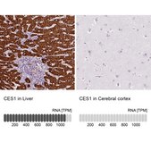 Anti-CES1 antibody produced in rabbit Prestige Antibodies&#174; Powered by Atlas Antibodies, affinity isolated antibody, buffered aqueous glycerol solution