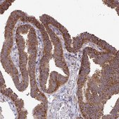 Anti-FMR1 antibody produced in rabbit Prestige Antibodies&#174; Powered by Atlas Antibodies, affinity isolated antibody, buffered aqueous glycerol solution