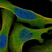 Anti-MAP3K2 antibody produced in rabbit Prestige Antibodies&#174; Powered by Atlas Antibodies, affinity isolated antibody, buffered aqueous glycerol solution