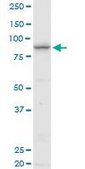 Anti-ELAC2 antibody produced in mouse purified immunoglobulin, buffered aqueous solution