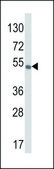 ANTI-VEGFC antibody produced in rabbit IgG fraction of antiserum, buffered aqueous solution