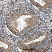 Anti-DHODH antibody produced in rabbit Prestige Antibodies&#174; Powered by Atlas Antibodies, affinity isolated antibody, buffered aqueous glycerol solution