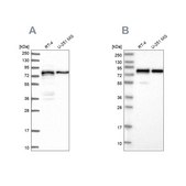 Anti-PEX5 antibody produced in rabbit Prestige Antibodies&#174; Powered by Atlas Antibodies, affinity isolated antibody, buffered aqueous glycerol solution