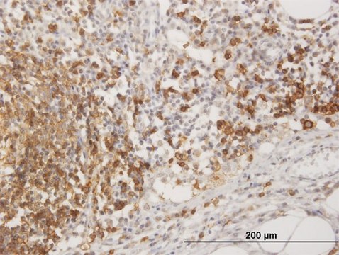 Anti-MS4A1 antibody produced in mouse purified immunoglobulin, buffered aqueous solution