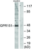 Anti-GPR151 antibody produced in rabbit affinity isolated antibody