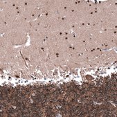 Monoclonal Anti-PTEN antibody produced in mouse Prestige Antibodies&#174; Powered by Atlas Antibodies, clone CL11723, purified immunoglobulin, buffered aqueous glycerol solution