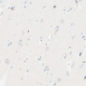 Anti-LAT antibody produced in rabbit Prestige Antibodies&#174; Powered by Atlas Antibodies, affinity isolated antibody, buffered aqueous glycerol solution