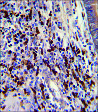 ANTI-CNOT8 (C-TERM) antibody produced in rabbit IgG fraction of antiserum, buffered aqueous solution