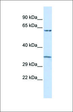 Anti-TRIM8 (ab2) antibody produced in rabbit affinity isolated antibody