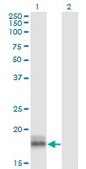 Monoclonal Anti-LMO2 antibody produced in mouse clone 6B8, purified immunoglobulin, buffered aqueous solution