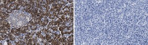 Anti-SEC61B Antibody, clone 1G14 ZooMAb&#174; Rabbit Monoclonal recombinant, expressed in HEK 293 cells