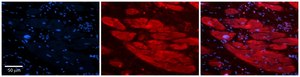 Anti-ENO3 (AB1) antibody produced in rabbit affinity isolated antibody