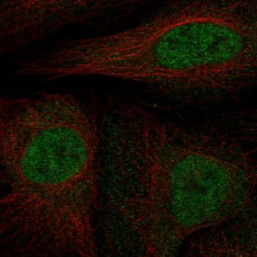 Anti-Cdkn2B Antibody Produced In Rabbit Prestige Antibodies&#174; Powered by Atlas Antibodies, affinity isolated antibody, buffered aqueous glycerol solution
