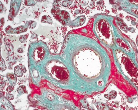 Masson-Goldner staining kit for the visualization of connective tissue with trichromic staining