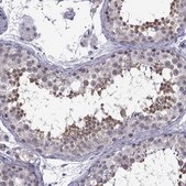 Anti-DDX20 antibody produced in rabbit Prestige Antibodies&#174; Powered by Atlas Antibodies, affinity isolated antibody, buffered aqueous glycerol solution