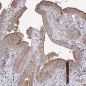 Anti-GRINA antibody produced in rabbit Prestige Antibodies&#174; Powered by Atlas Antibodies, affinity isolated antibody, buffered aqueous glycerol solution