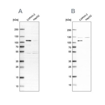 Anti-SP1 antibody produced in rabbit Ab1, Prestige Antibodies&#174; Powered by Atlas Antibodies, affinity isolated antibody, buffered aqueous glycerol solution