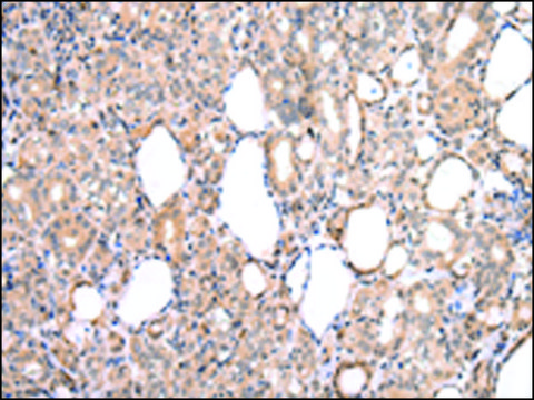 Anti-CDK8 affinity isolated antibody