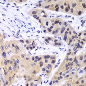 Anti-IRF3 antibody produced in rabbit