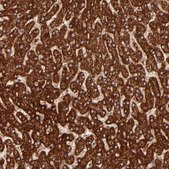 Anti-DLST antibody produced in rabbit Prestige Antibodies&#174; Powered by Atlas Antibodies, affinity isolated antibody, buffered aqueous glycerol solution