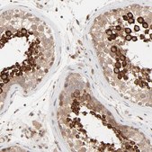 Anti-RAB5C antibody produced in rabbit Prestige Antibodies&#174; Powered by Atlas Antibodies, affinity isolated antibody, buffered aqueous glycerol solution