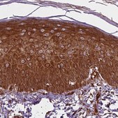 Anti-PKP3 antibody produced in rabbit Prestige Antibodies&#174; Powered by Atlas Antibodies, affinity isolated antibody, buffered aqueous glycerol solution