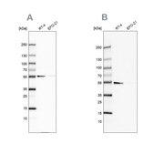 Anti-ATP5A1 antibody produced in rabbit Prestige Antibodies&#174; Powered by Atlas Antibodies, affinity isolated antibody, buffered aqueous glycerol solution