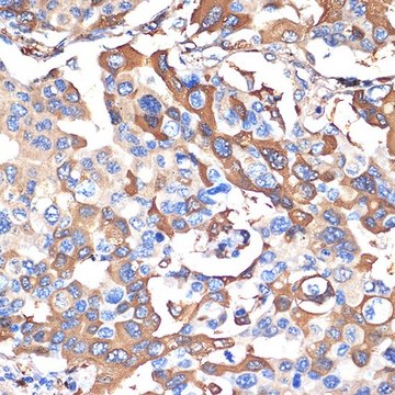 Anti-VPS28 antibody produced in rabbit