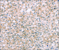 Anti-ROR1 affinity isolated antibody