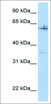 Anti-SPDEF (AB2) antibody produced in rabbit affinity isolated antibody