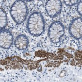 Anti-YIF1A antibody produced in rabbit Prestige Antibodies&#174; Powered by Atlas Antibodies, affinity isolated antibody, buffered aqueous glycerol solution