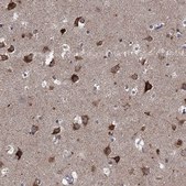 Anti-SLC2A13 antibody produced in rabbit Prestige Antibodies&#174; Powered by Atlas Antibodies, affinity isolated antibody, buffered aqueous glycerol solution