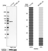 Anti-PARP2 antibody produced in rabbit Prestige Antibodies&#174; Powered by Atlas Antibodies, affinity isolated antibody, buffered aqueous glycerol solution