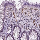 Anti-VWF antibody produced in rabbit Ab2, Prestige Antibodies&#174; Powered by Atlas Antibodies, affinity isolated antibody, buffered aqueous glycerol solution