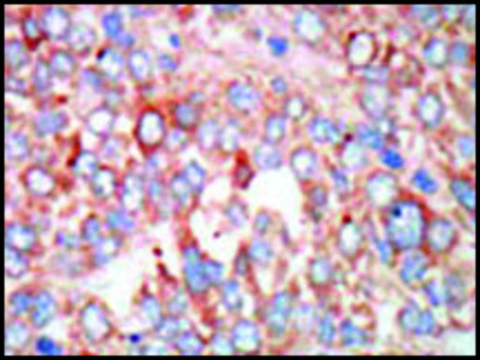 Anti-MST3 (C-term) antibody produced in rabbit IgG fraction of antiserum, buffered aqueous solution