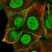 Anti-NOTCH2 antibody produced in rabbit Prestige Antibodies&#174; Powered by Atlas Antibodies, affinity isolated antibody, buffered aqueous glycerol solution