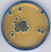 Sabouraud Dextrose Agar ReadyPlate&#8482;, ISO, FDA-BAM, EP, USP, plate diam. 90&#160;mm, box of 20 or 120 plates