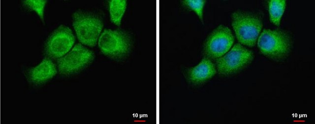 Anti-PLAUR antibody produced in rabbit affinity isolated antibody, buffered aqueous solution