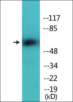 Anti-phospho-Chk2 (pThr387) antibody produced in rabbit affinity isolated antibody