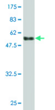 Monoclonal Anti-PMM2 antibody produced in mouse clone 2A5, purified immunoglobulin, buffered aqueous solution