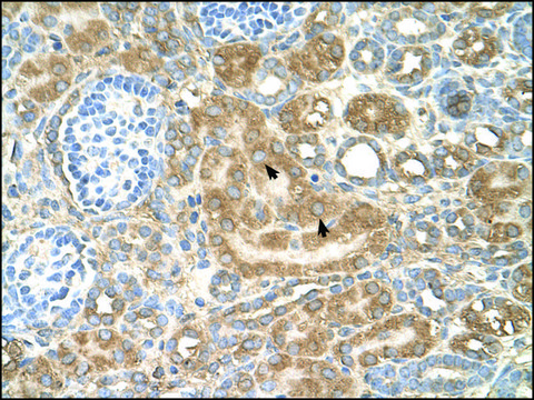 Anti-SPTLC1 antibody produced in rabbit affinity isolated antibody