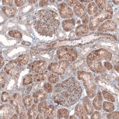 Monoclonal Anti--G6PC antibody produced in mouse Prestige Antibodies&#174; Powered by Atlas Antibodies, clone CL5818, purified immunoglobulin, buffered aqueous glycerol solution