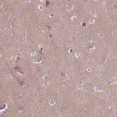 Anti-MAPT antibody produced in rabbit Prestige Antibodies&#174; Powered by Atlas Antibodies, affinity isolated antibody, buffered aqueous glycerol solution