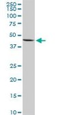 Anti-NOV antibody produced in rabbit purified immunoglobulin, buffered aqueous solution