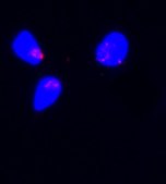 Rabbit Monoclonal ANTI-FLAG&#174; Clone SIGI-25 clone SIG1-25, ascites fluid
