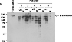 Anti-Fibronectin antibody produced in rabbit affinity isolated antibody, buffered aqueous solution