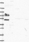 Anti-TRIM29 antibody produced in rabbit Prestige Antibodies&#174; Powered by Atlas Antibodies, affinity isolated antibody, buffered aqueous glycerol solution