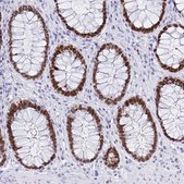 Monoclonal Anti-SATB2 antibody produced in mouse Prestige Antibodies&#174; Powered by Atlas Antibodies, clone CL0276, purified immunoglobulin, buffered aqueous glycerol solution